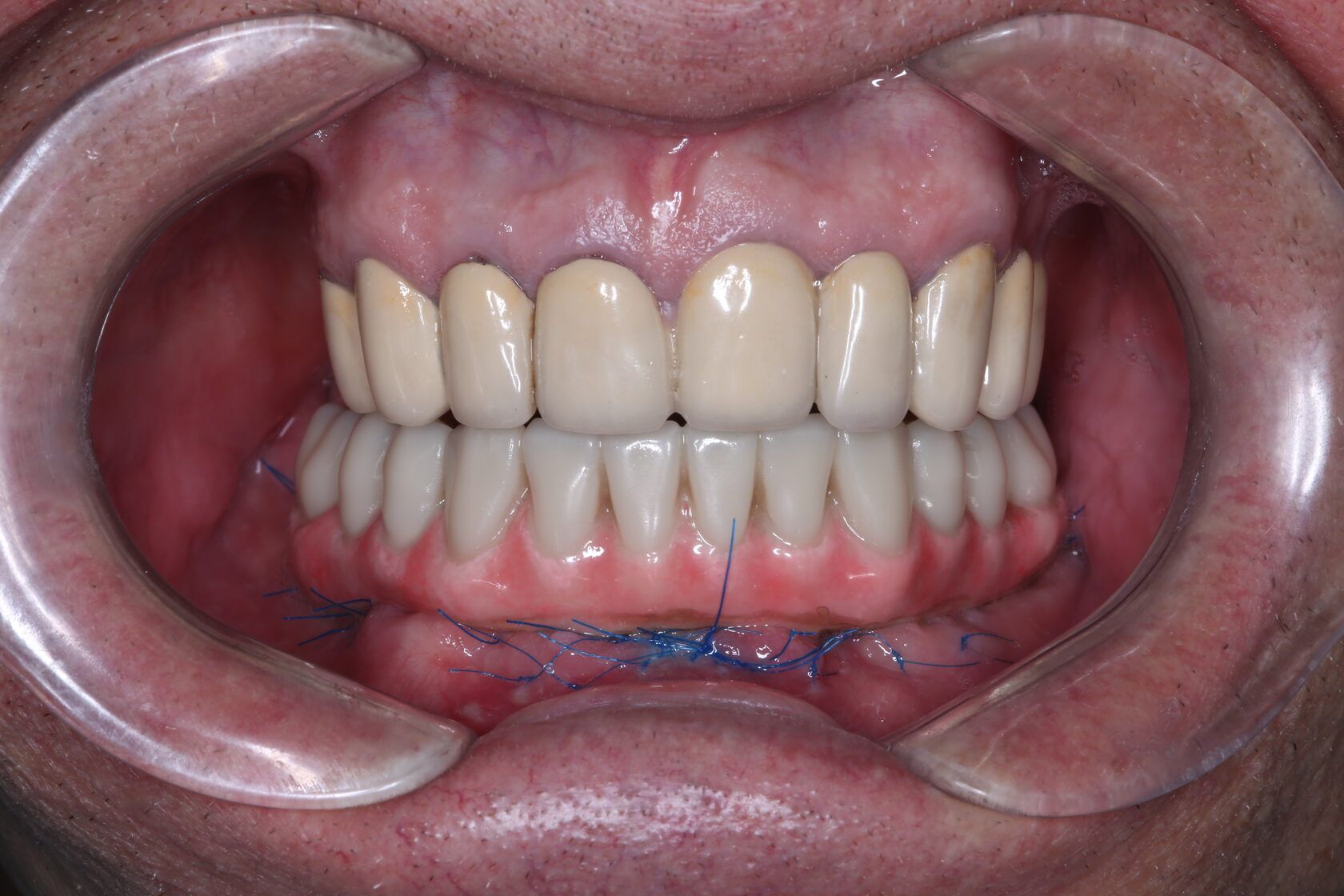 Фото из галереи №1