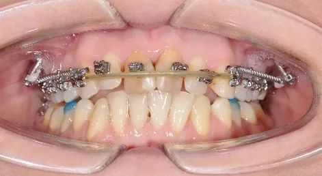 Фото из галереи №1