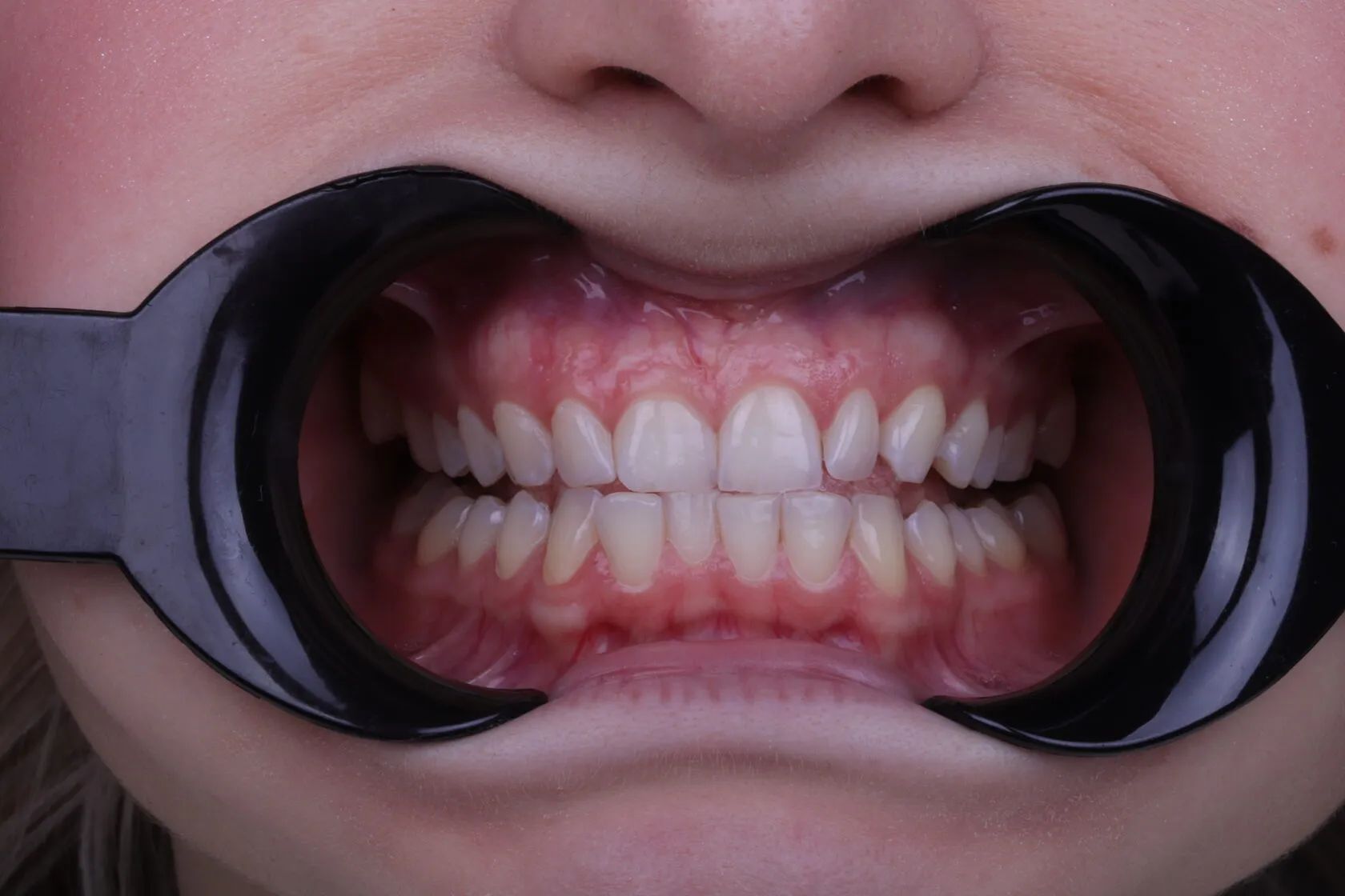 Фото из галереи №1