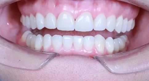 Фото из галереи №2