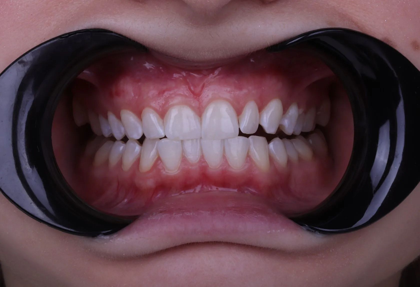 Фото из галереи №2